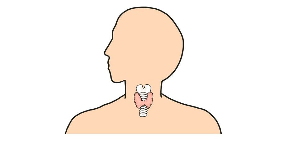 橋本病